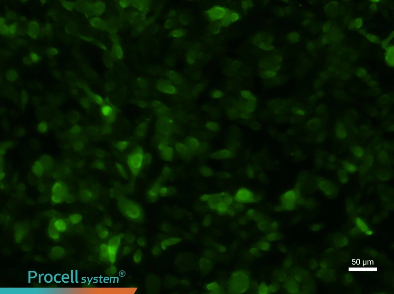 PC-3-GFP - 1
