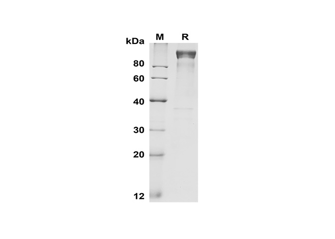 Recombinant Human IL22 Protein(Avi,His Tag)-产品推荐-1