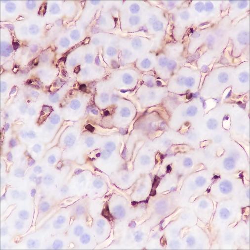 Recombinant MHC Class I Monoclonal Antibody - 3
