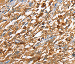 CAPG Polyclonal Antibody - 3
