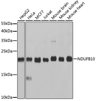 Western blot analysis of extracts of various cell lines using NDUFB10 Polyclonal Antibody at 1:1000 dilution.