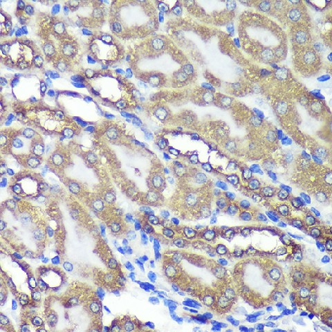 Immunohistochemistry of paraffin-embedded Mouse kidney using ANKLE2 Polyclonal Antibody at dilution of 1:100 (40x lens).Perform microwave antigen retrieval with 10 mM PBS buffer pH 7.2 before commencing with IHC staining protocol.