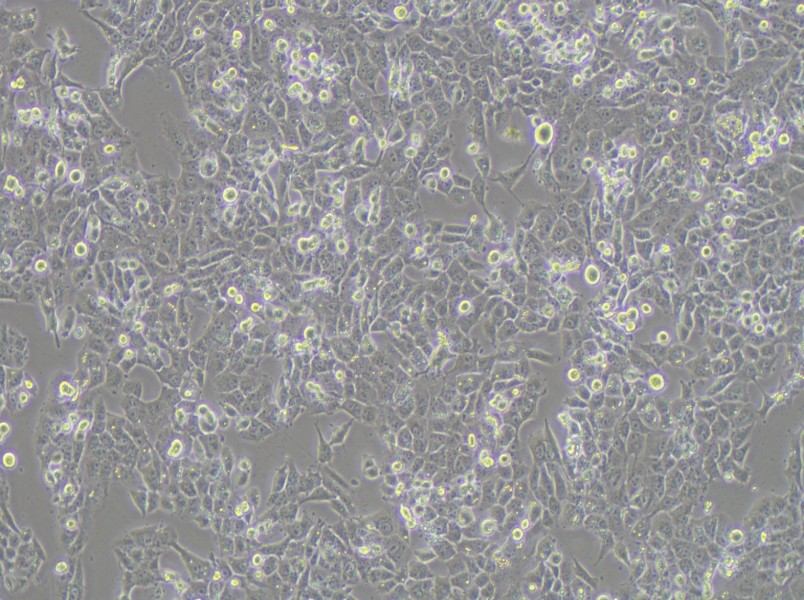 NCI-H1915 Cell Complete Medium - 2