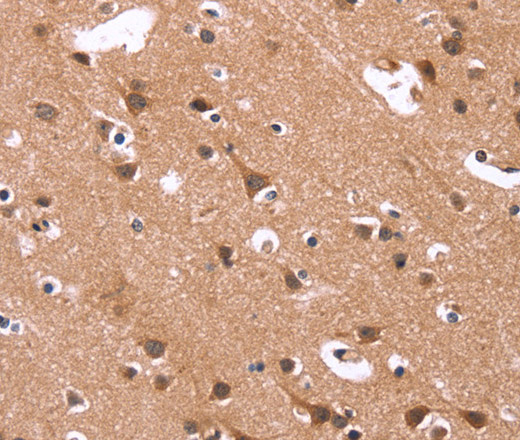 Immunohistochemistry of paraffin-embedded Human brain  using HSD17B1 Polyclonal Antibody at dilution of 1:40