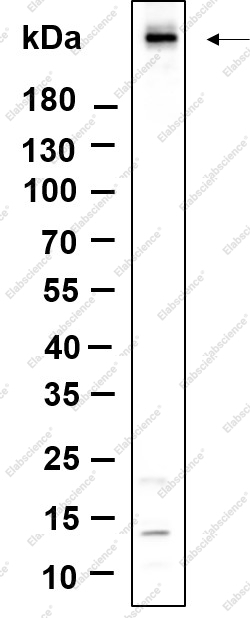 Recombinant Phospho-ATM (Ser1981) Monoclonal Antibody - 1
