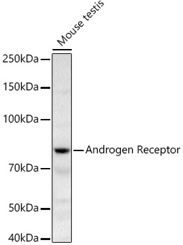 Western blot analysis of extracts of Mouse testis using Androgen Receptor Polyclonal Antibody at 1:500 dilution.