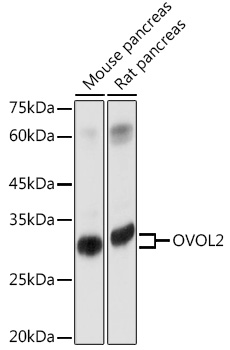 Western blot analysis of extracts of various cell lines using OVOL2 Polyclonal Antibody at 1:1000 dilution.