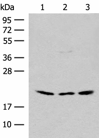 Western blot analysis of HEPG2 and Hela cell Mouse liver tissue lysates  using RPL23A Polyclonal Antibody at dilution of 1:300