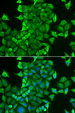 Immunofluorescence analysis of HeLa cells using CARS Polyclonal Antibody Blue: DAPI for nuclear staining.