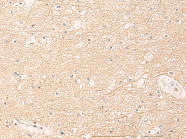 Immunohistochemistry of paraffin-embedded Human brain tissue  using ELP1 Polyclonal Antibody at dilution of 1:30(?200)