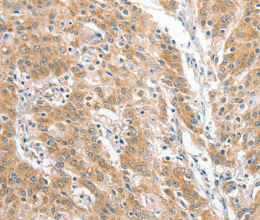 COL4A3BP Polyclonal Antibody - 3