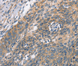 PLEKHO1 Polyclonal Antibody - 3