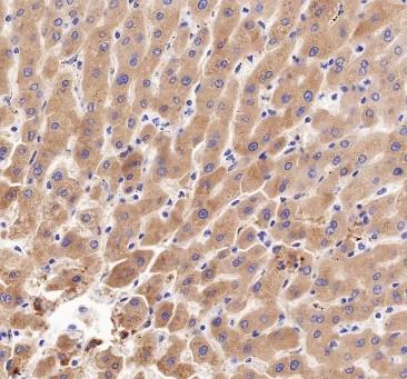 Recombinant Prothrombin Monoclonal Antibody-searchlist-3