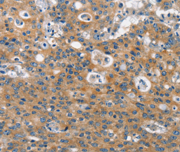 CLTC Polyclonal Antibody - 3