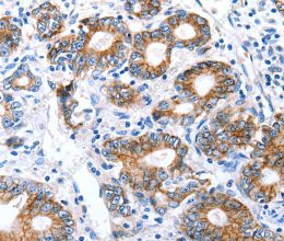 Claudin 7 Polyclonal Antibody - 3