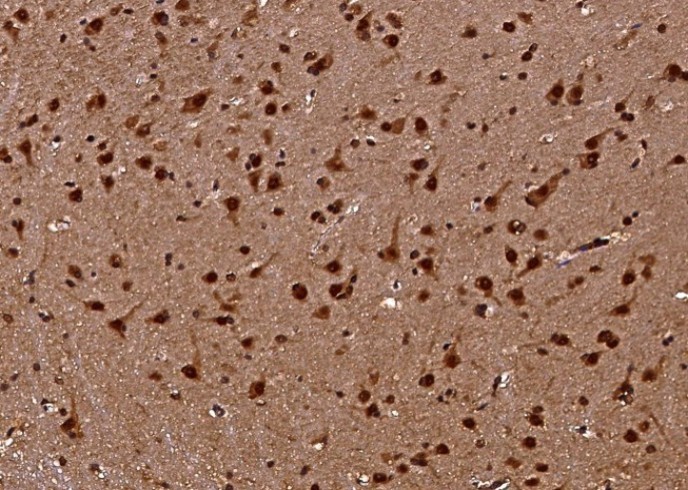 Recombinant CHI3L2/YKL-39 Monoclonal Antibody - small - 3