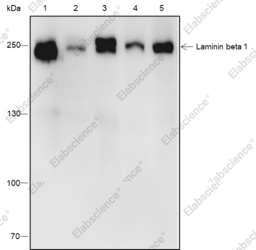 Recombinant Laminin beta 1 Monoclonal Antibody - 1