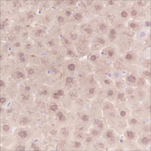 Recombinant SETBP1 Monoclonal Antibody - small - 4