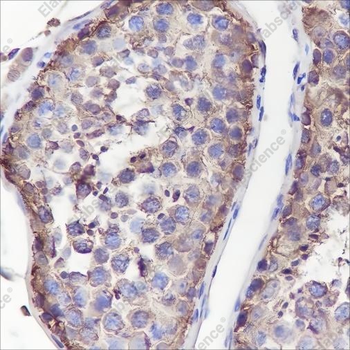 Recombinant Muscarinic Acetylcholine Receptor 2/CM2 Monoclonal Antibody - 2