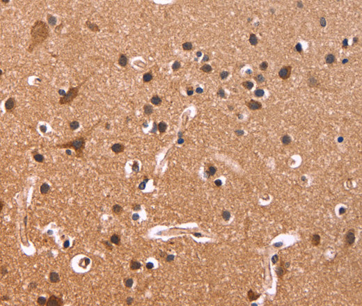 Immunohistochemistry of paraffin-embedded Human brain tissue using CSNK1D Polyclonal Antibody at dilution 1:50