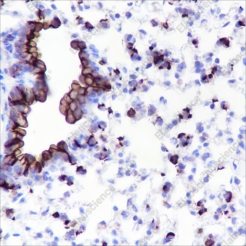 Recombinant MUC1 Monoclonal Antibody - 3