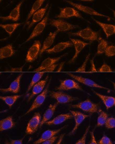 Immunofluorescence analysis of L929 cells using HIBADH Polyclonal Antibody at dilution of 1:100. Blue: DAPI for nuclear staining.