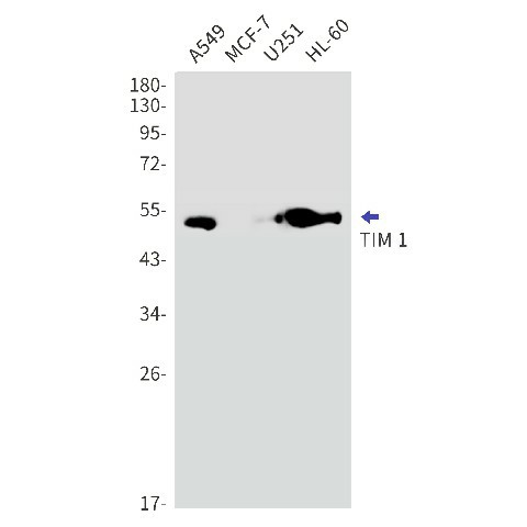 Western blot detection of TIM 1 in A549,MCF-7,U251,HL-60 cell lysates using TIM 1 Rabbit mAb(1:1000 diluted).Predicted band size:39kDa.Observed band size:50kDa.