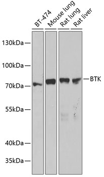 Western blot analysis of extracts of various cell lines using BTK Polyclonal Antibody at dilution of 1:1000.