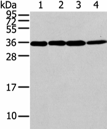 Western Blot analysis of Lovo, 293T, Jurkat and hela cell using CBX7 Polyclonal Antibody at dilution of 1/200