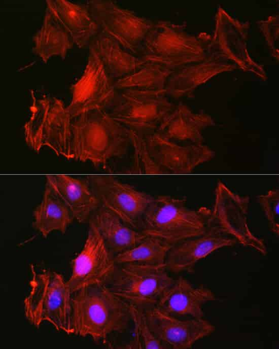 Immunofluorescence analysis of U2OS cells using Gelsolin Polyclonal Antibody at dilution of 1:50 (40x lens). Blue: DAPI for nuclear staining.