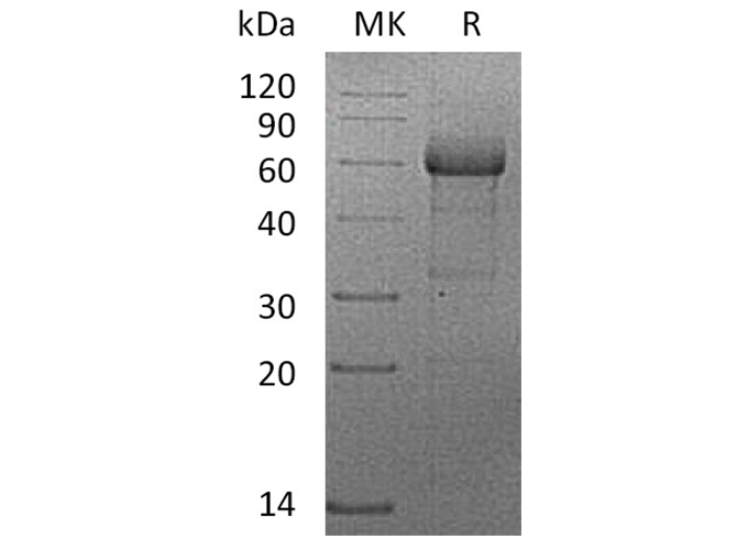 Recombinant Human TNFRSF1B/CD120b Protein (mFc Tag)