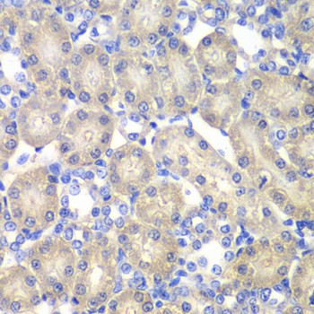 Immunohistochemistry of paraffin-embedded Rat kidney using ACY1 Polyclonal Antibody at dilution of 1:100 (40x lens).