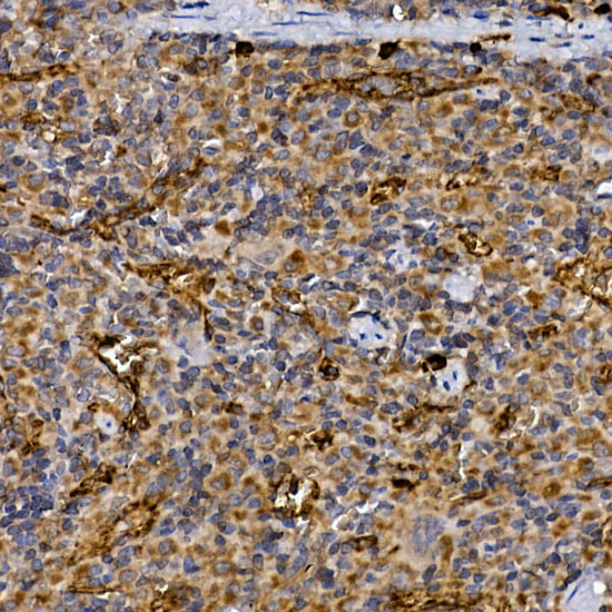 Immunohistochemistry of paraffin-embedded rat spleen using CD26/DPP4 Polyclonal Antibody at dilution of 1:25 (40x lens).Perform high pressure antigen retrieval with 10 mM citrate buffer pH 6.0 before commencing with IHC staining protocol.