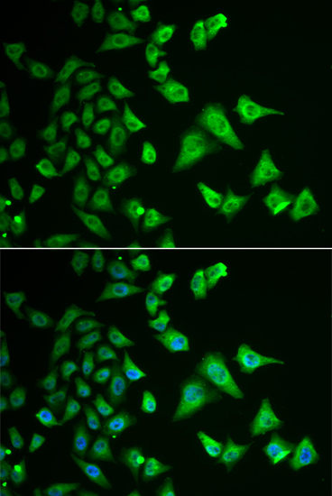 Immunofluorescence analysis of HeLa cells using DHRS2 Polyclonal Antibody Blue: DAPI for nuclear staining.