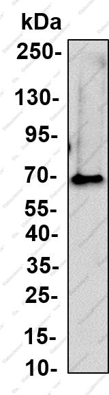 Recombinant RPN1 Monoclonal Antibody - 3