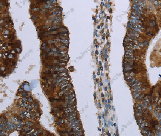 HMGCL Polyclonal Antibody - 3