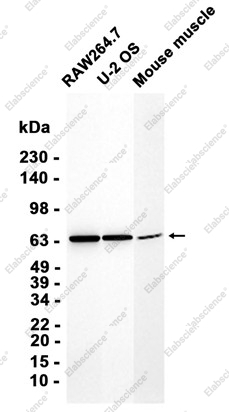 Recombinant CDK5RAP3 Monoclonal Antibody - 1