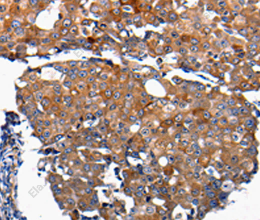 FGF2 Polyclonal Antibody - 2