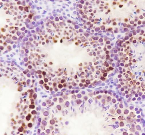 Recombinant ILF3 Monoclonal Antibody - small - 7