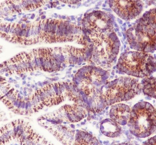 Recombinant CPS1 Monoclonal Antibody - small - 5