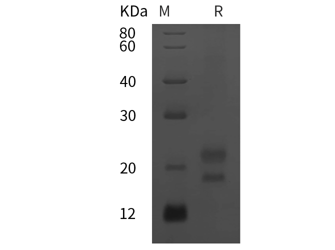 Recombinant Human PD1 Protein(His Tag)-产品推荐-1
