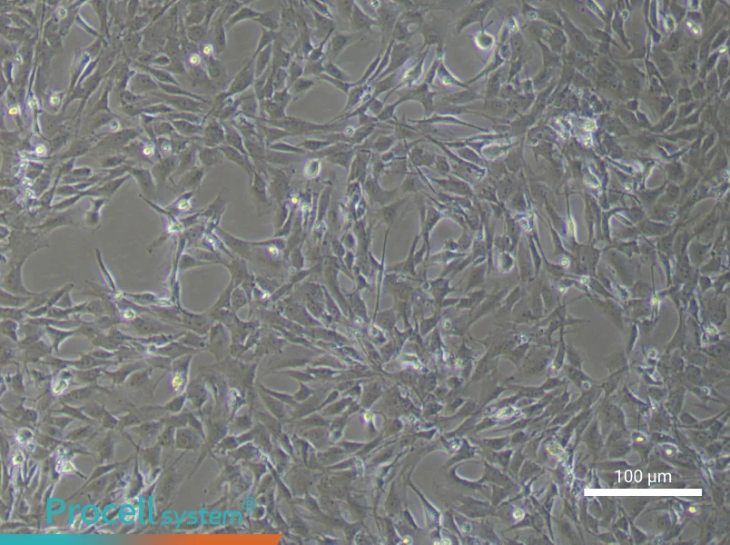 Rat Pulmonary Artery Smooth Muscle Cell Complete MediumRat Pulmonary Artery Smooth Muscle Cell Complete Medium - 2