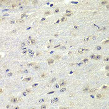 Immunohistochemistry of paraffin-embedded mouse brain using FMRP Polyclonal antibody at dilution of 1:100 (40x lens).Perform microwave antigen retrieval with 10 mM PBS buffer pH 7.2 before commencing with IHC staining protocol.
