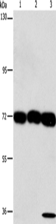 Western Blot analysis of 293T, hepG2 and A549 cell using CKAP4 Polyclonal Antibody at dilution of 1:1250