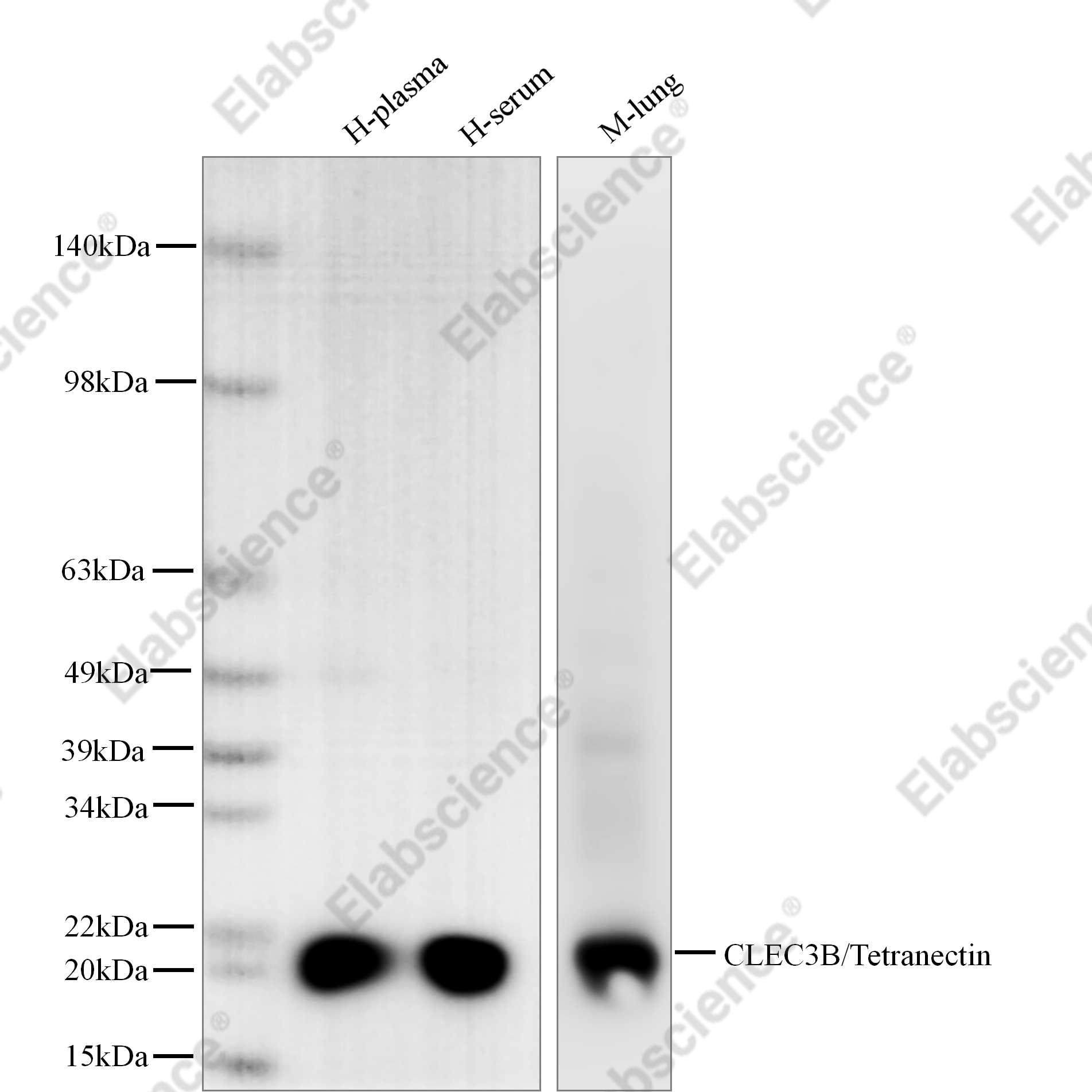 Recombinant CLEC3B/Tetranectin Monoclonal Antibody - 1