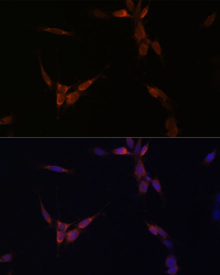 Immunofluorescence analysis of NIH/3T3 cells using PP2A Catalytic α Polyclonal antibody at dilution of 1:100. Blue:DAPI for nuclear staining.