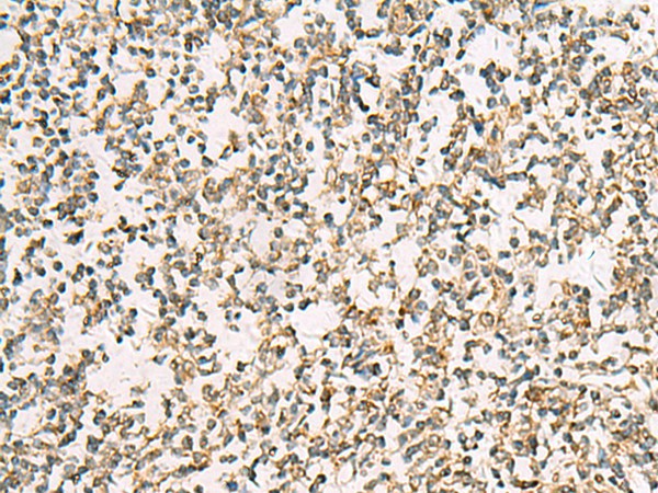 Immunohistochemistry of paraffin-embedded Human tonsil tissue  using ZPBP2 Polyclonal Antibody at dilution of 1:50(?200)