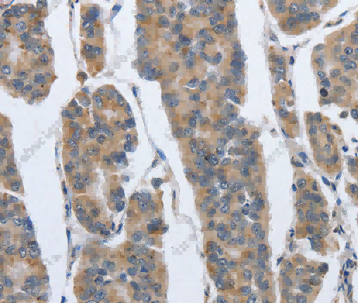 IPO7 Polyclonal Antibody - 3