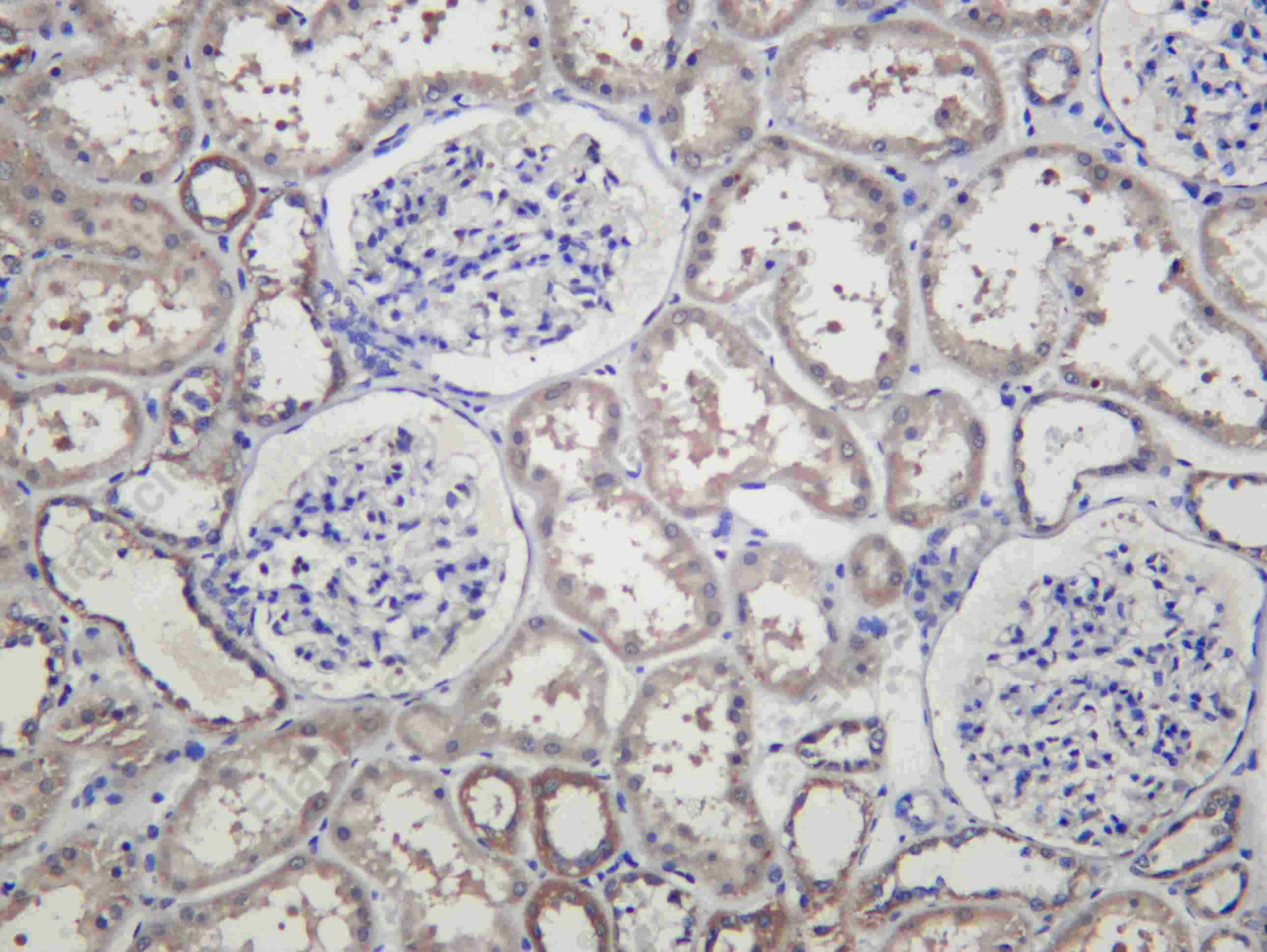 Recombinant TRADD Monoclonal Antibody - 1