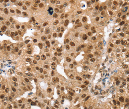 SMARCB1 Polyclonal Antibody - 2